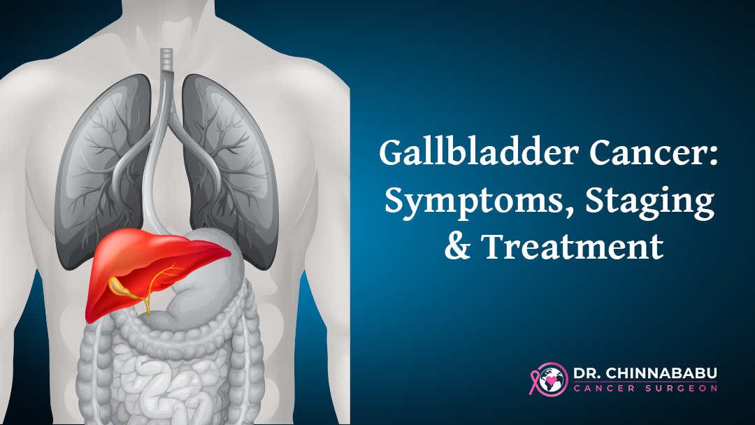 Gallbladder Cancer: Symptoms. Staging & Treatment